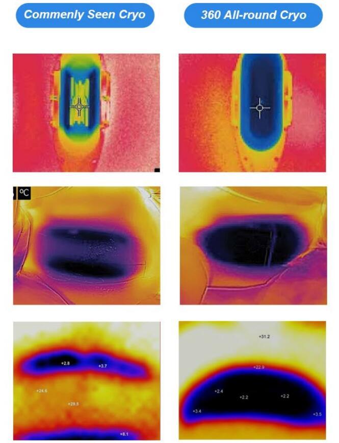 Cryolipolysis performance